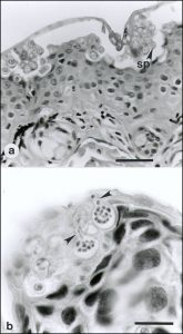 Chytridiomycosis Micrograph