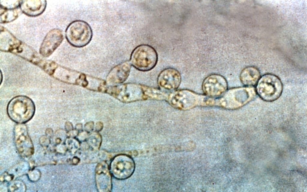 Candida albicans yeast and hyphae