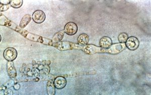 #162: <em>Candida albicans</em>