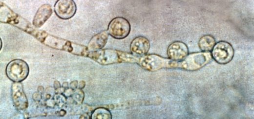 Candida albicans yeast and hyphae