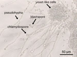 Candida albicans biofilm