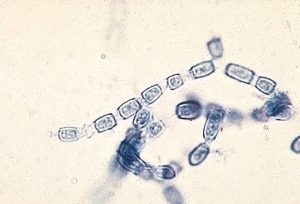 Coccidioides arthrospores