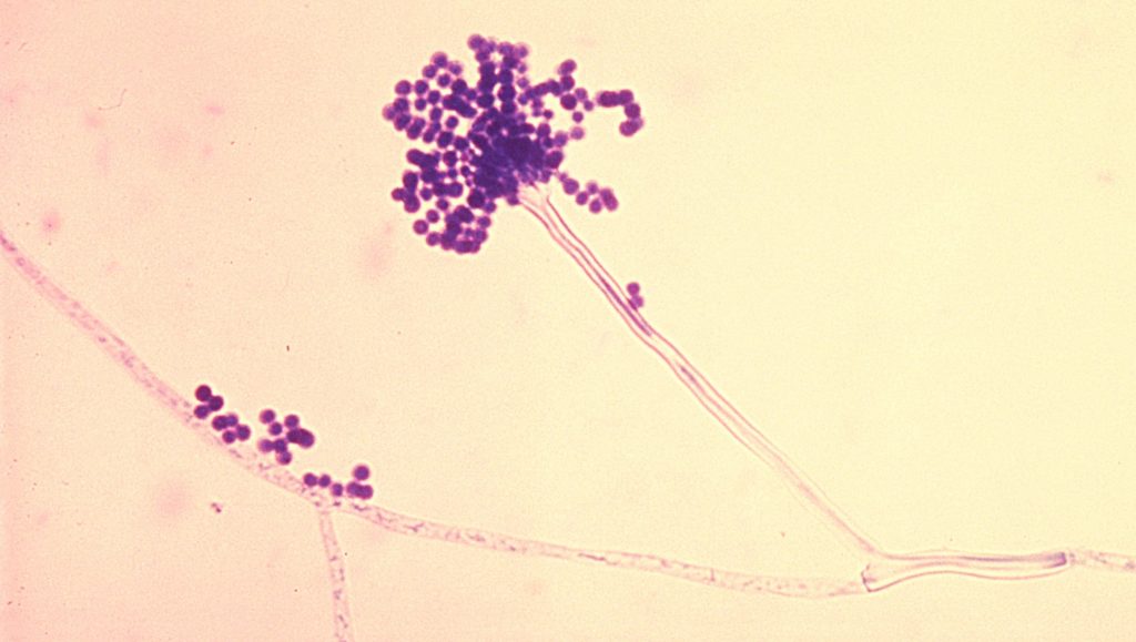 Aspergillus sp. conidia