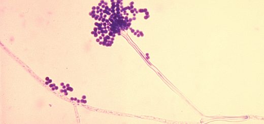 Aspergillus sp. conidia