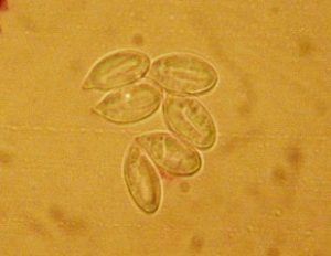 Longitudinally lined Clitopilus spores