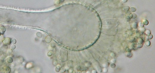 Aspergillus flavus