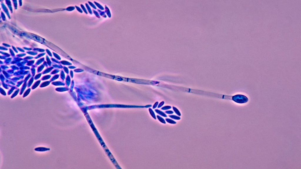 Fusarium verticillioides spores