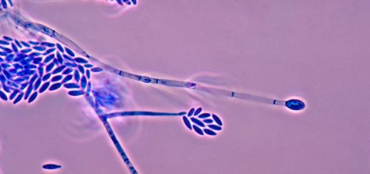 Fusarium verticillioides spores