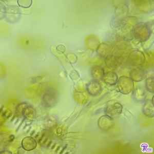 Four spores on a basidium from Phleogena basidium