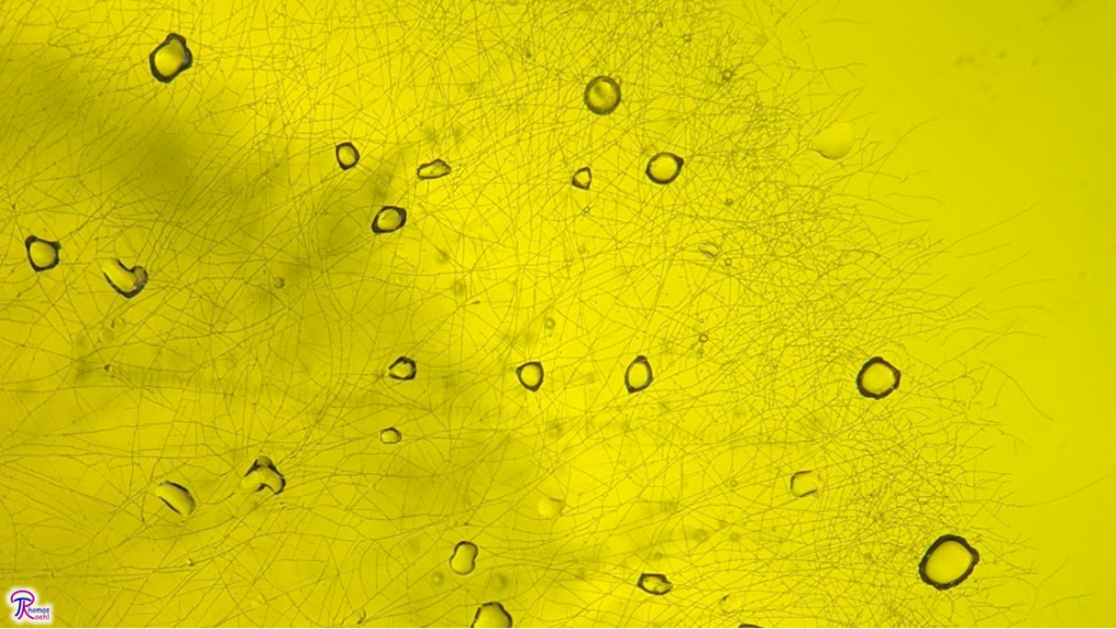 Yellow hyphae