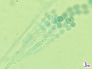 Spores of Penicillium